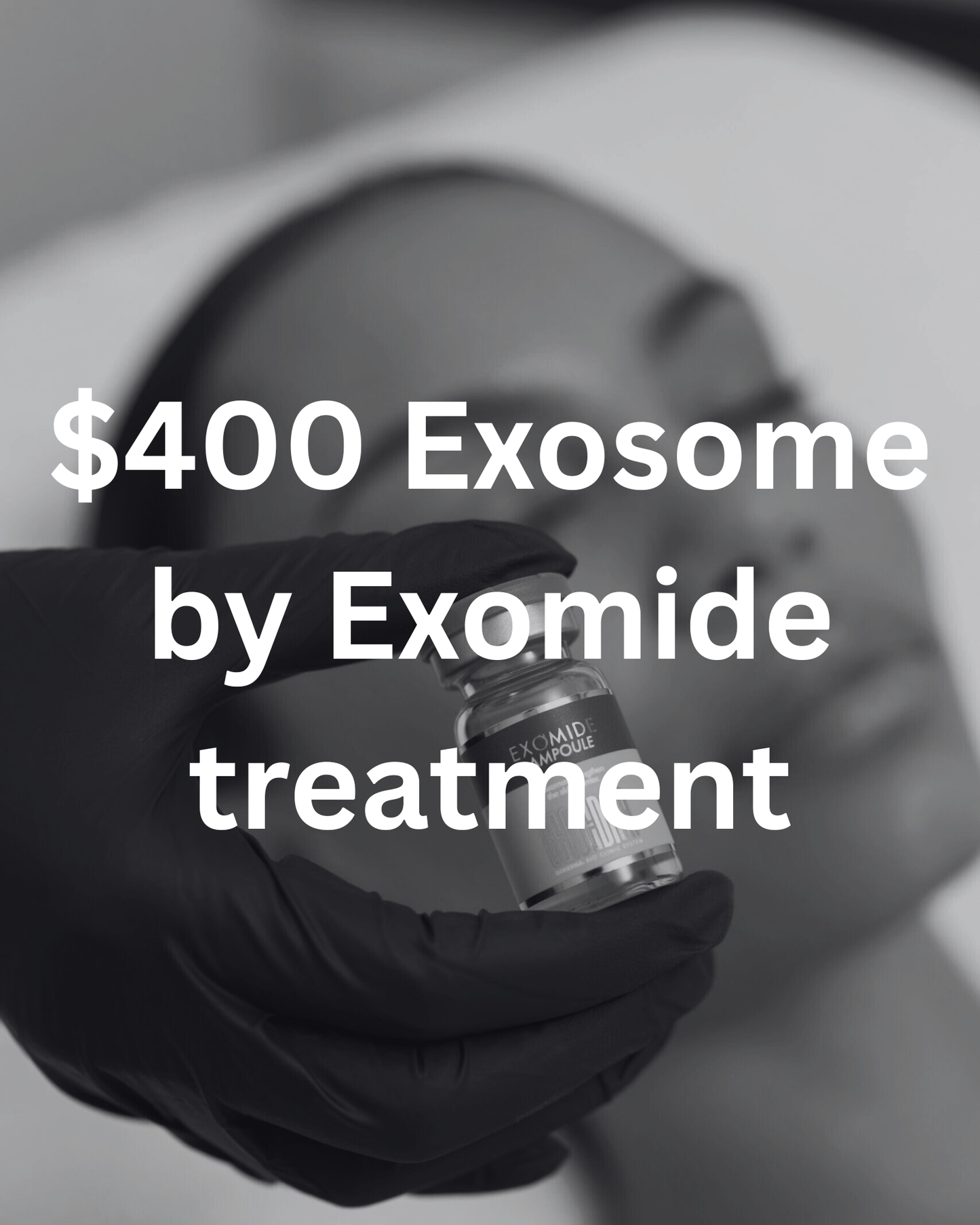 $400 Exosome treatment