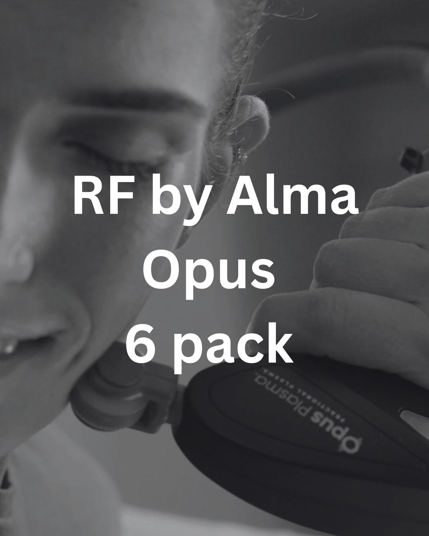 RF alma Opus